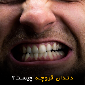 دندان قروچه چیست؟